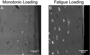 Imagen: Las imágenes del microscopio de transmisión de rayos-x del daño generado en una muestra de hueso y teñida con acetato-uranil-plomo. El blanco es la tinción del micro-daño, gris es el hueso, y el negro es el fondo. A la izquierda hay una carga única de la muestra, y a la derecha es la carga repetida (Fotografía cortesía de la Universidad  de Cornell).